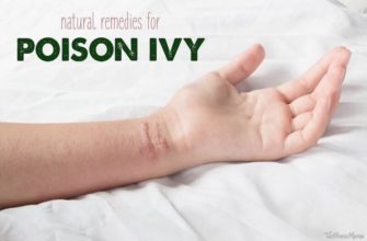 Natural Remedies to Soothe Poison Ivy Itch: Effective Treatment Options